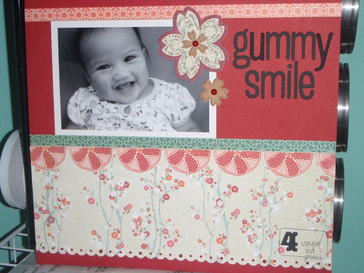 gummy smile